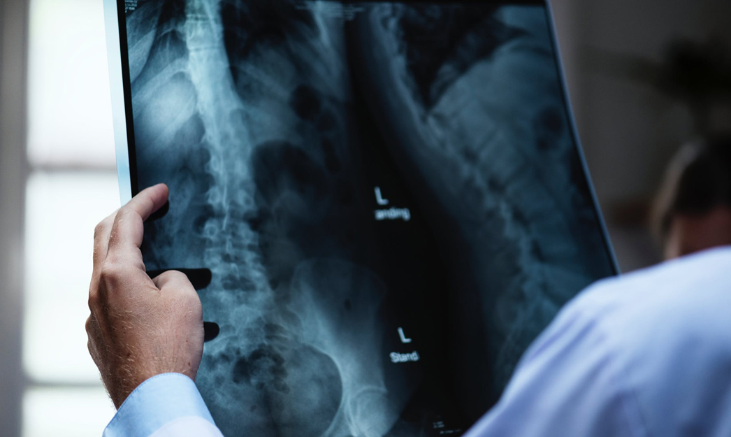 Smart Plan Major Medical